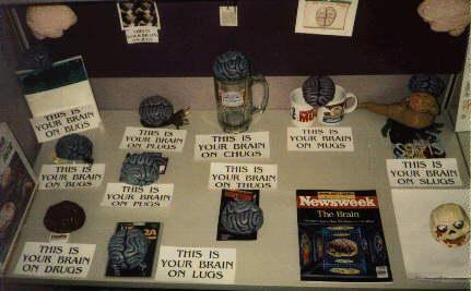 Brain Museum